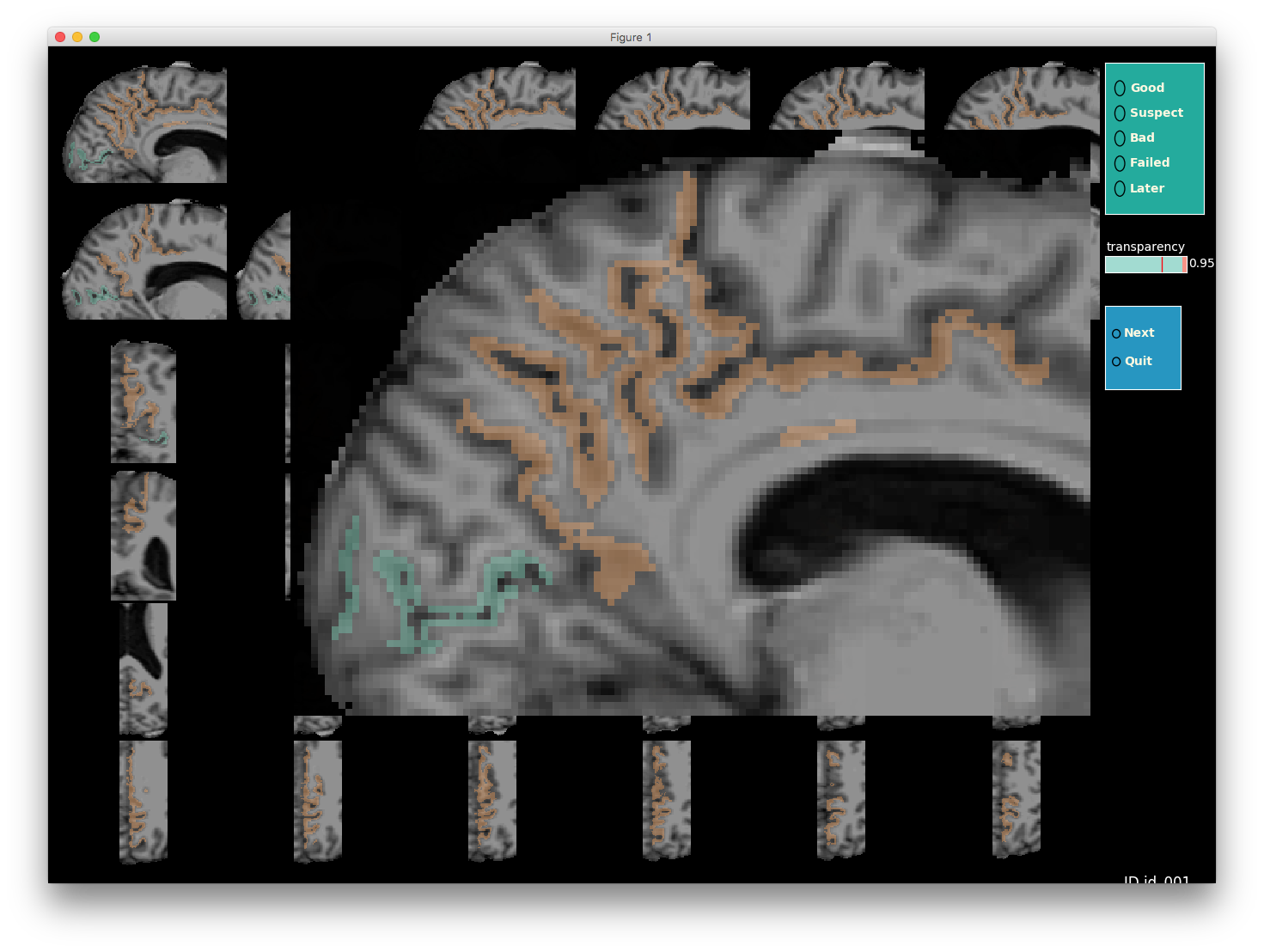 _images/single_label_cortical_zoomed_in.png