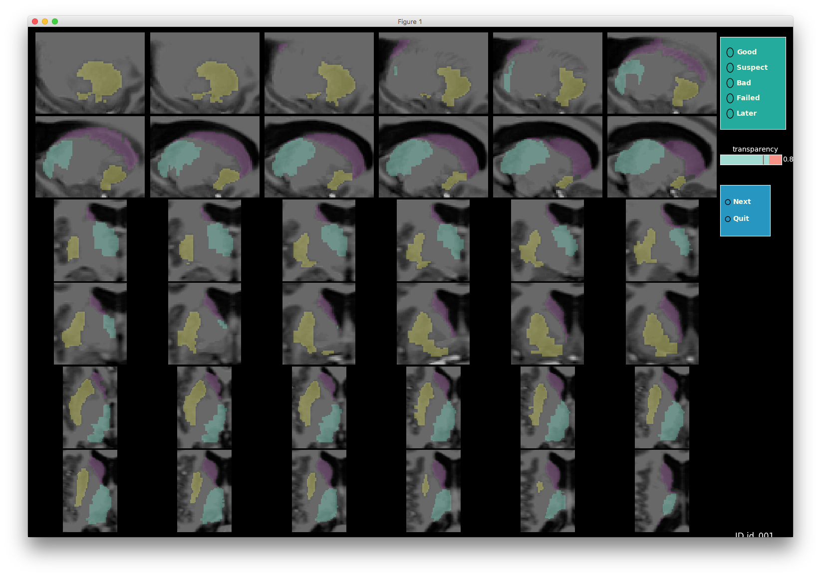 _images/subcortical_multiple.png