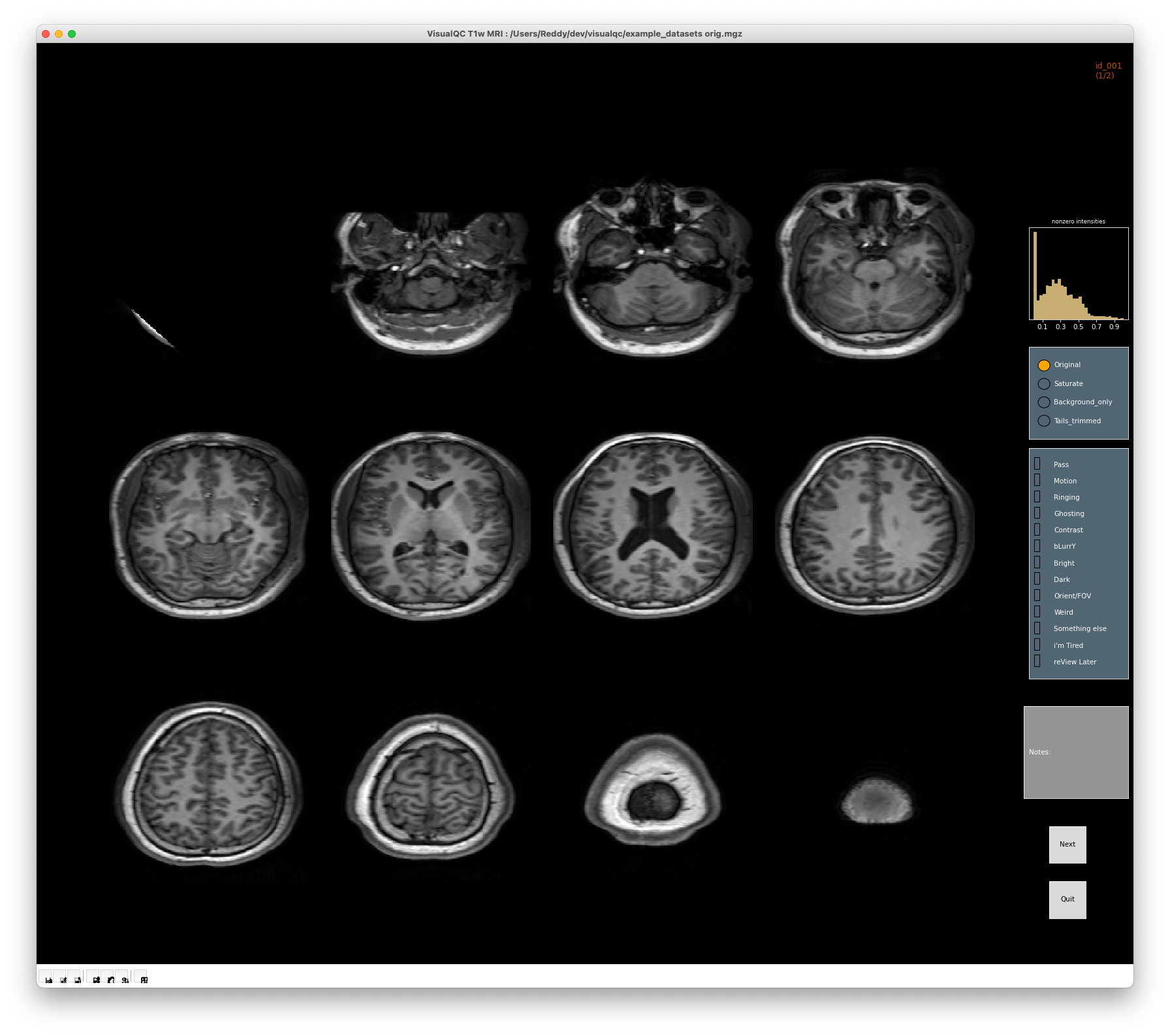 _images/t1_mri_simple_single_view.png